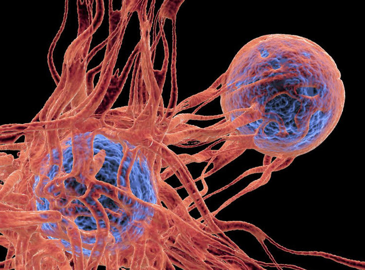 The Cancer Warning Signs Every Man Needs to Know